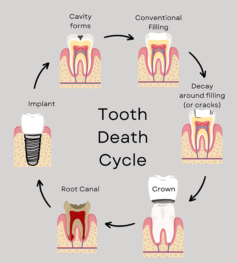 Toothache Cavity Treatment Toothache Cavity Treatment
