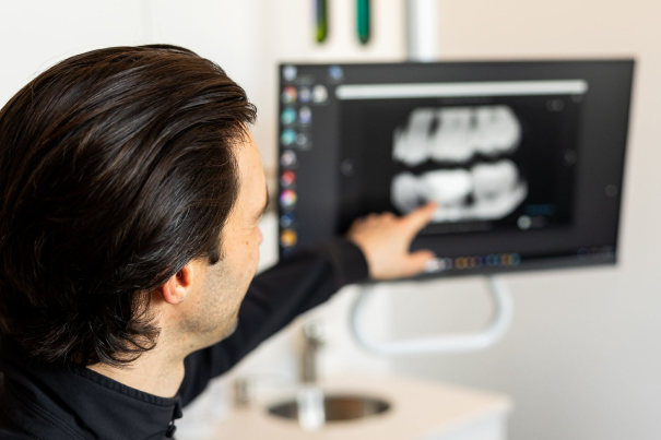 Why Choose Restoration Dentistry for Resin Infiltration For Small Cavities?